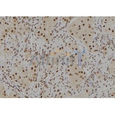 Phospho-CTGF (Ser118) Antibody - AF7037 at 1/100 staining human kidney tissue sections by IHC-P.