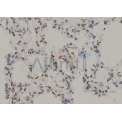 Phospho-PKC beta 1 (Thr642+Thr644) Antibody  - AF7191 at 1/100 staining rat lung tissue sections by IHC-P.