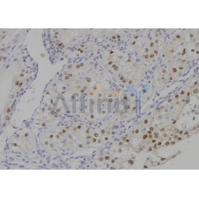 Phospho-PKC beta 1 (Thr642+Thr644) Antibody  - AF7191 at 1/100 staining human kidney tissue sections by IHC-P.