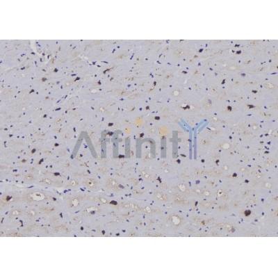 Phospho-EEF2 (Thr57) Antibody - AF7221 at 1/100 staining human brain tissue sections by IHC-P.
