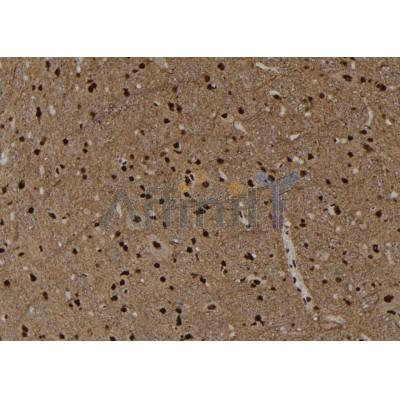 Phospho-B Raf (Ser729) Antibody - AF7232 at 1/100 staining rat brain tissue sections by IHC-P.