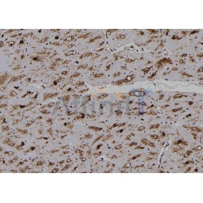 Phospho-B Raf (Ser729) Antibody - AF7232 at 1/100 staining human brain tissue sections by IHC-P.