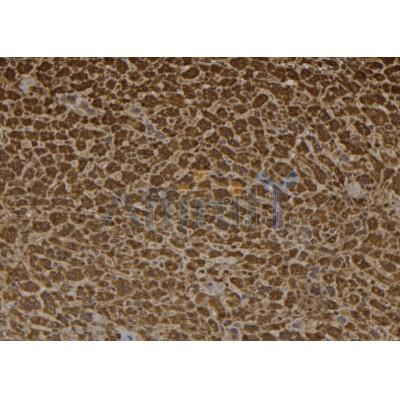 Phospho-MyoD1 (Thr115) Antibody - AF7233 at 1/100 staining mouse liver tissue sections by IHC-P.