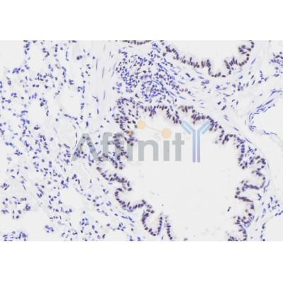 Phospho-GATA2 (Ser192) Antibody - AF7269 at 1/100 staining rat lung tissue sections by IHC-P.