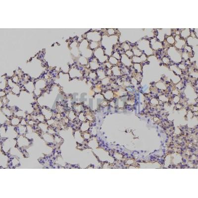Phospho-EPHA2 (Tyr772) Antibody - AF7282 at 1/100 staining mouse lung tissue sections by IHC-P.