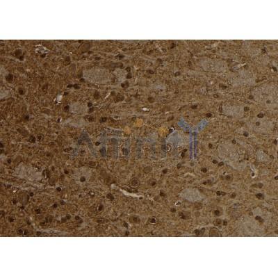 Phospho-TMEM173/STING (Ser366) Antibody - AF7416 at 1/100 staining rat brain tissue sections by IHC-P.