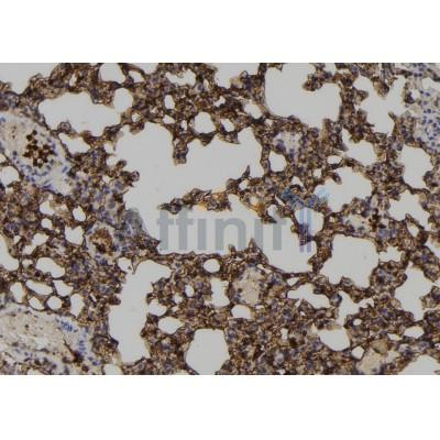 Phospho-ERK8 (Tyr177) Antibody - AF7423 at 1/100 staining mouse lung tissue sections by IHC-P.