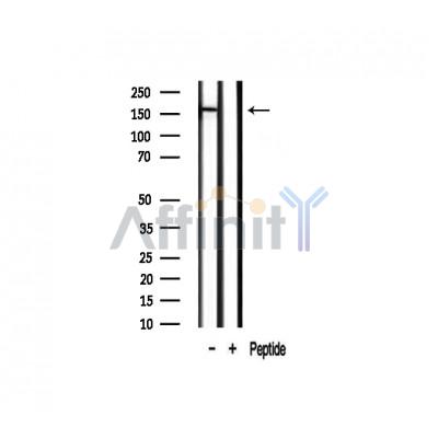 Gli3 Antibody - Western blot analysis of extracts from Human Lung tissue sample,using Gli3 Antibody(AF7949).