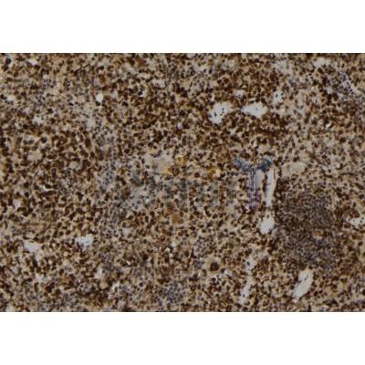 PADI2 Antibody - DF12015 at 1/100 staining Mouse spleen tissue by IHC-P.
