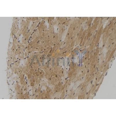 TMPRSS4 Antibody - DF12037 at 1/100 staining Mouse heart tissue by IHC-P.