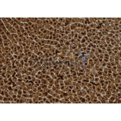 S100A14 Antibody - DF12042 at 1/100 staining Rat liver tissue by IHC-P.