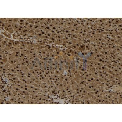 AIMP2/p38 Antibody - DF12048 at 1/100 staining Mouse liver tissue by IHC-P.