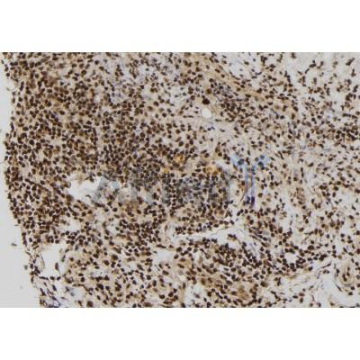 RBM15 Antibody - DF12061 at 1/100 staining Human spleen tissue by IHC-P.