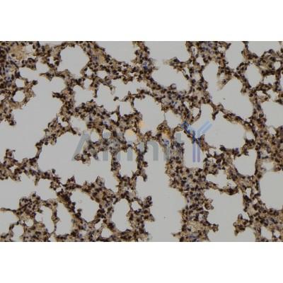 CHCHD2 Antibody - DF12066 at 1/100 staining Mouse lung tissue by IHC-P.