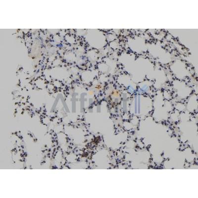 TET2 Antibody - DF12089 at 1/100 staining Mouse lung tissue by IHC-P.