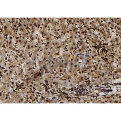 Estrogen Sulfotransferase Antibody - DF12137 at 1/100 staining Human liver tissue by IHC-P.