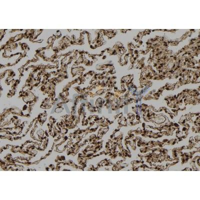 CCP1 Antibody - DF12146 at 1/100 staining Human lung tissue by IHC-P.