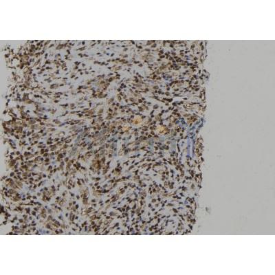 PTPN23 Antibody - DF12169 at 1/100 staining Human spleen tissue by IHC-P.