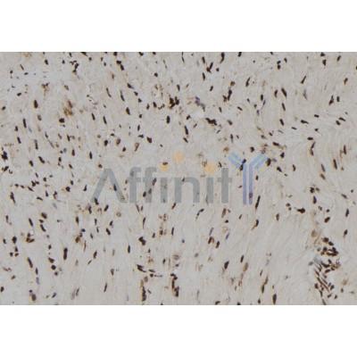 RNH1 Antibody - DF12170 at 1/100 staining Rat heart tissue by IHC-P.