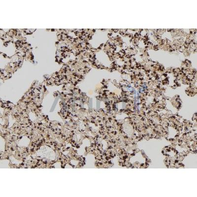 TIA1 Antibody - DF12176 at 1/100 staining Rat lung tissue by IHC-P.