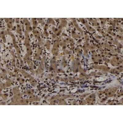 TRIM44 Antibody - DF12177 at 1/100 staining Human liver tissue by IHC-P.