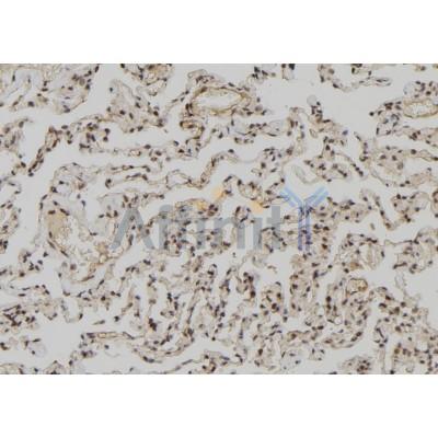 ZCCHC11 Antibody - DF12183 at 1/100 staining Human lung tissue by IHC-P.