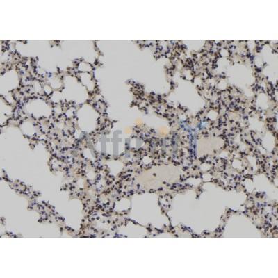 LARP7 Antibody - DF12208 at 1/100 staining Mouse lung tissue by IHC-P.