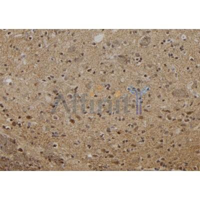 OIP5 Antibody - DF12217 at 1/100 staining Rat brain tissue by IHC-P.