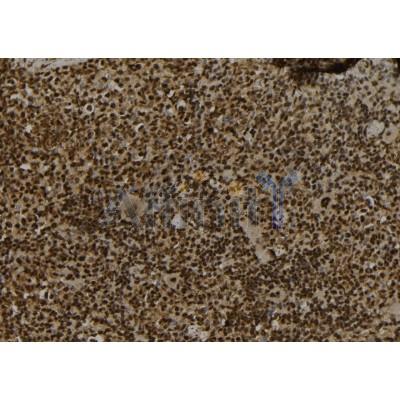 SECISBP2 Antibody - DF12228 at 1/100 staining Mouse spleen tissue by IHC-P.