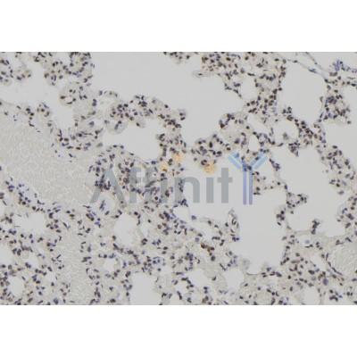 AEBP2 Antibody - DF12245 at 1/100 staining Rat lung tissue by IHC-P.