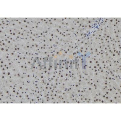 AGO2 Antibody - DF12246 at 1/100 staining Rat liver tissue by IHC-P.