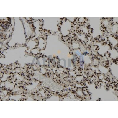 CEP164 Antibody - DF12253 at 1/100 staining Rat lung tissue by IHC-P.