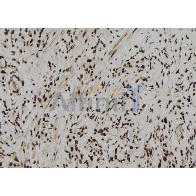 CPSF4 Antibody - DF12260 at 1/100 staining Human gastric tissue by IHC-P.