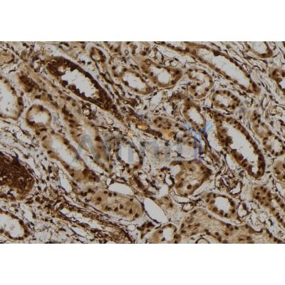 DHX9 Antibody - DF12266 at 1/100 staining Human kidney tissue by IHC-P.