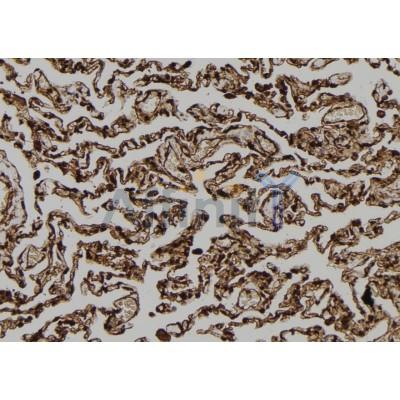 FAM96B Antibody - DF12272 at 1/100 staining Human lung tissue by IHC-P.