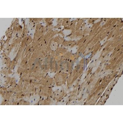 KIF18A Antibody - DF12286 at 1/100 staining Mouse heart tissue by IHC-P.