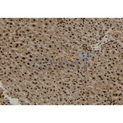 SPG11 Antibody - DF12322 at 1/100 staining Mouse liver tissue by IHC-P.