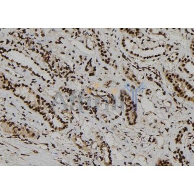 WDR46 Antibody - DF12342 at 1/100 staining Human kidney tissue by IHC-P.