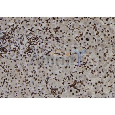 ZC3HAV1 Antibody - DF12343 at 1/100 staining Human liver tissue by IHC-P.