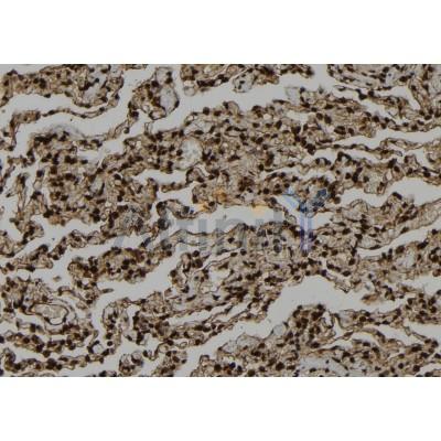 SMYD3 Antibody - DF12477 at 1/100 staining Human lung tissue by IHC-P.
