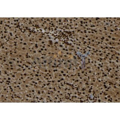 TEX10 Antibody - DF12486 at 1/100 staining Mouse liver tissue by IHC-P.