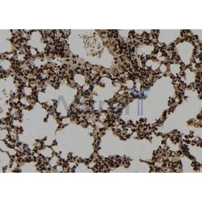 WDR18 Antibody - DF12502 at 1/100 staining Mouse lung tissue by IHC-P.