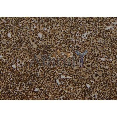 WRAP53 Antibody - DF12504 at 1/100 staining Mouse spleen tissue by IHC-P.