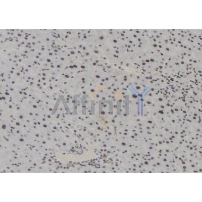 Phospho-MAPKAPK2 (Thr222) Antibody - AF2361 at 1/100 staining Mouse liver tissue by IHC-P.
