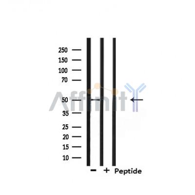 Retinoic Acid Receptor beta Antibody - Western blot analysis of extracts from mouse lung, using Retinoic Acid Receptor beta Antibody.