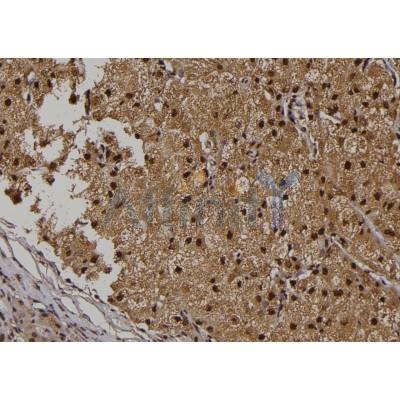 iNOS Antibody - AF6270 at 1/100 staining Human liver tissue by IHC-P.