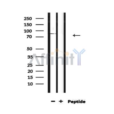DDX4 Antibody - Western blot analysis of extracts from mouse lung, using DDX4 Antibody.