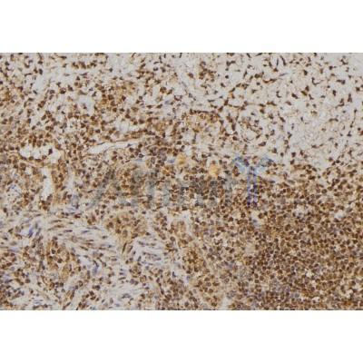 B Raf Antibody - DF3095 at 1/100 staining Human spleen tissue by IHC-P.