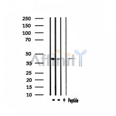 M-CK Antibody - Western blot analysis of extracts from mouse lung, rat brain, using M-CK Antibody.