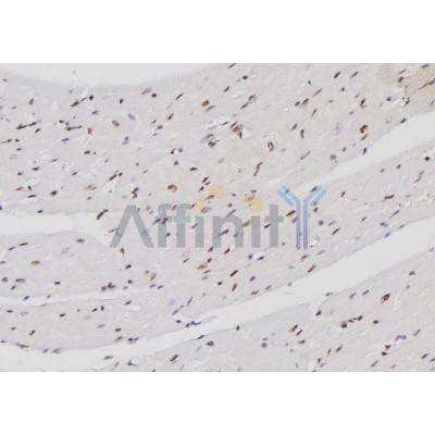 FXR2 Antibody - DF3195 at 1/100 staining Mouse heart tissue by IHC-P.